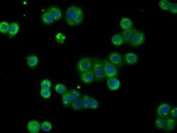 ACAT2 Monoclonal Antibody (OTI1G6), TrueMAB , OriGene 30 &mu;L; Unconjugated:Antibodies,