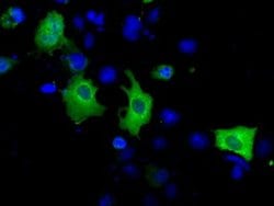 ACAT2 Monoclonal Antibody (OTI3C9), TrueMAB , OriGene:Antibodies:Primary