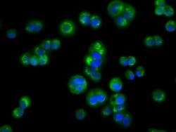 ACAT2 Monoclonal Antibody (OTI3C9), TrueMAB , OriGene 30 &mu;L; Unconjugated:Antibodies,