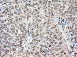 ACAT2 Monoclonal Antibody (OTI5F7), TrueMAB , OriGene 30 &mu;L; Unconjugated:Antibodies,