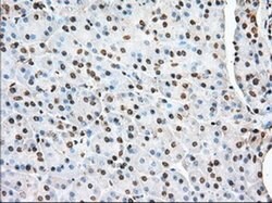 ACAT2 Monoclonal Antibody (OTI5F7), TrueMAB , OriGene 30 &mu;L; Unconjugated:Antibodies,
