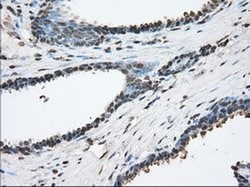 ACAT2 Monoclonal Antibody (OTI5F7), TrueMAB , OriGene 30 &mu;L; Unconjugated:Antibodies,