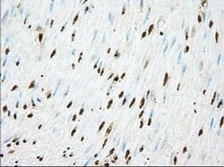 ACAT2 Monoclonal Antibody (OTI5F7), TrueMAB , OriGene 30 &mu;L; Unconjugated:Antibodies,