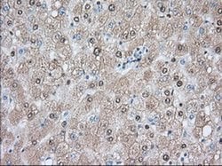 ACAT2 Monoclonal Antibody (OTI5F7), TrueMAB , OriGene 30 &mu;L; Unconjugated:Antibodies,