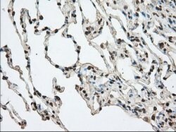 ACAT2 Monoclonal Antibody (OTI5F7), TrueMAB , OriGene 30 &mu;L; Unconjugated:Antibodies,
