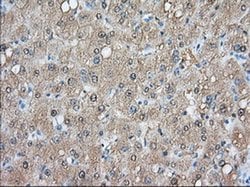ACAT2 Monoclonal Antibody (OTI1G6), TrueMAB , OriGene:Antibodies:Primary