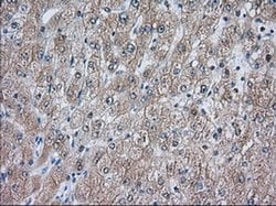 ACAT2 Mouse anti-Canine, Human, Rat, Clone: OTI3E2, liquid, TrueMAB 100