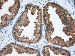 ACAT2 Monoclonal Antibody (OTI3C9), TrueMAB , OriGene 30 &mu;L; Unconjugated:Antibodies,