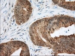 ACAT2 Monoclonal Antibody (OTI3C9), TrueMAB , OriGene 30 &mu;L; Unconjugated:Antibodies,