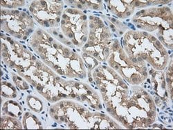 ACAT2 Monoclonal Antibody (OTI3C9), TrueMAB , OriGene 30 &mu;L; Unconjugated:Antibodies,