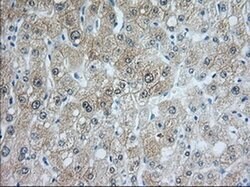 ACAT2 Monoclonal Antibody (OTI3C9), TrueMAB , OriGene 30 &mu;L; Unconjugated:Antibodies,
