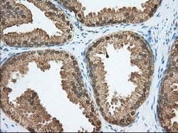 ACAT2 Mouse anti-Canine, Human, Rat, Clone: OTI5A2, lyophilized, TrueMAB 100 &mu;g | Buy Online | OriGene | Fisher Scientific