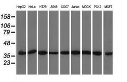 ACAT2 Mouse anti-Canine, Human, Rat, Clone: OTI1C5, lyophilized, TrueMAB