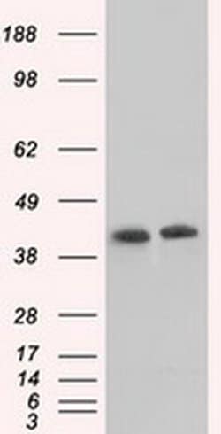 ACAT2 Monoclonal Antibody (OTI5F7), TrueMAB , OriGene 30 &mu;L; Unconjugated:Antibodies,