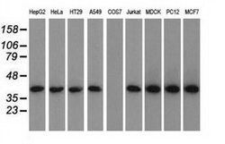 ACAT2 Monoclonal Antibody (OTI5F7), TrueMAB , OriGene 30 &mu;L; Unconjugated:Antibodies,