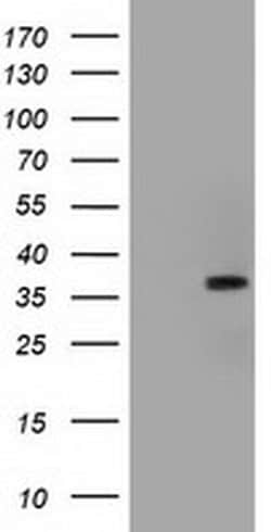 ACAT2 Monoclonal Antibody (OTI1G6), TrueMAB , OriGene 30 &mu;L; Unconjugated:Antibodies,
