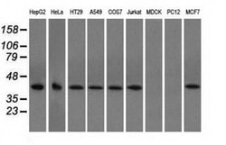 ACAT2 Monoclonal Antibody (OTI1G6), TrueMAB , OriGene 30 &mu;L; Unconjugated:Antibodies,