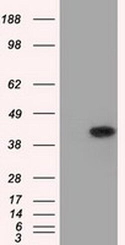 ACAT2 Monoclonal Antibody (OTI3C9), TrueMAB , OriGene 30 &mu;L; Unconjugated:Antibodies,