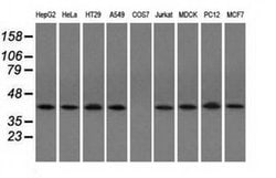 ACAT2 Monoclonal Antibody (OTI3C9), TrueMAB , OriGene 30 &mu;L; Unconjugated:Antibodies,