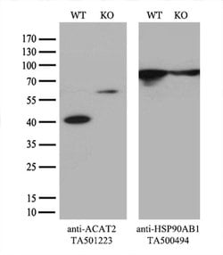 ACAT2 Monoclonal Antibody (OTI3C9), TrueMAB , OriGene 30 &mu;L; Unconjugated:Antibodies,