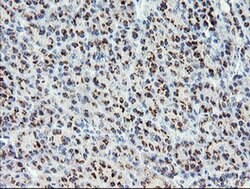 ACBD3 Monoclonal Antibody (OTI3E7), TrueMAB , OriGene 100 &mu;L; Unconjugated:Antibodies,