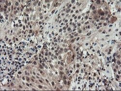 ACBD3 Monoclonal Antibody (OTI3A1), TrueMAB , OriGene 100 &mu;L; Unconjugated:Antibodies,