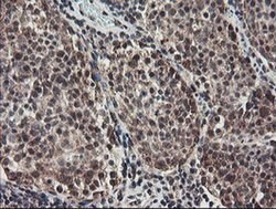ACBD3 Monoclonal Antibody (OTI3A1), TrueMAB , OriGene 100 &mu;L; Unconjugated:Antibodies,