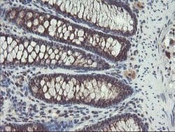 ACBD3 Monoclonal Antibody (OTI3A1), TrueMAB , OriGene 100 &mu;L; Unconjugated:Antibodies,