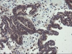 ACBD3 Monoclonal Antibody (OTI3A1), TrueMAB , OriGene 100 &mu;L; Unconjugated:Antibodies,