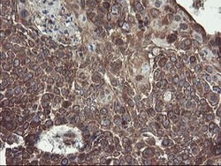 ACBD3 Mouse anti-Human, Mouse, Rat, Clone: OTI1B5, lyophilized, TrueMAB