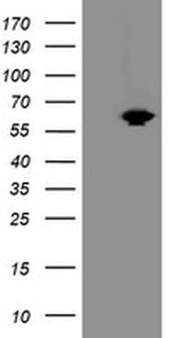 ACBD3 Monoclonal Antibody (OTI2B12), TrueMAB , OriGene 100 &mu;L | Buy Online | OriGene | Fisher Scientific