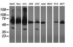 ACBD3 Mouse anti-Human, Mouse, Rat, Clone: OTI1B5, lyophilized, TrueMAB