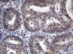 ACD Mouse anti-Human, Clone: OTI2B1, lyophilized, TrueMAB 100 &mu;g; Unconjugated:Antibodies,