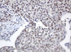 ACD Mouse anti-Human, Clone: OTI2B1, lyophilized, TrueMAB 100 &mu;g; Unconjugated:Antibodies,