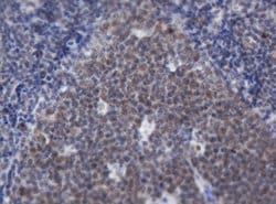 ACD Mouse anti-Human, Clone: OTI2B1, lyophilized, TrueMAB 100 &mu;g; Unconjugated:Antibodies,