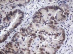 ACD Mouse anti-Human, Clone: OTI2B1, lyophilized, TrueMAB 100 &mu;g; Unconjugated:Antibodies,