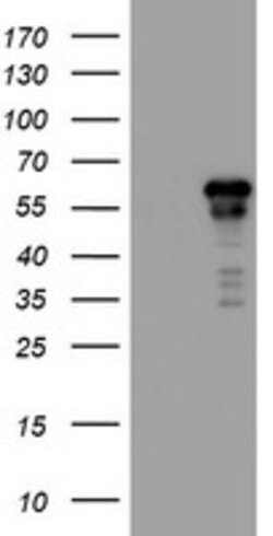 ACD Mouse anti-Human, Clone: OTI2B1, lyophilized, TrueMAB 100 &mu;g; Unconjugated:Antibodies,