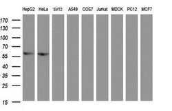 ACD Mouse anti-Human, Clone: OTI2B1, lyophilized, TrueMAB 100 &mu;g; Unconjugated:Antibodies,