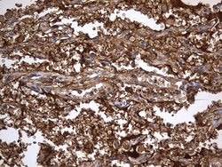 ACE Monoclonal Antibody (OTI2C8), TrueMAB , OriGene 100 &mu;L; Unconjugated:Antibodies,