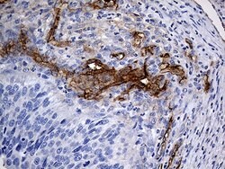 ACE Monoclonal Antibody (OTI2G5), TrueMAB , OriGene 100 &mu;L; Unconjugated:Antibodies,