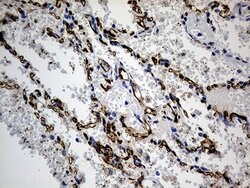 ACE Monoclonal Antibody (OTI2G5), TrueMAB , OriGene 100 &mu;L; Unconjugated:Antibodies,