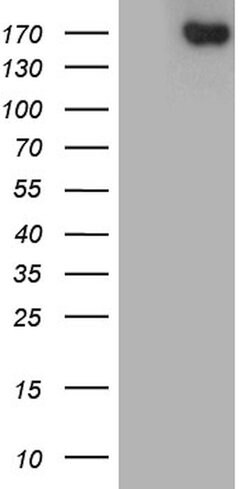 ACE Monoclonal Antibody (OTI2C8), TrueMAB , OriGene 100 &mu;L; Unconjugated:Antibodies,