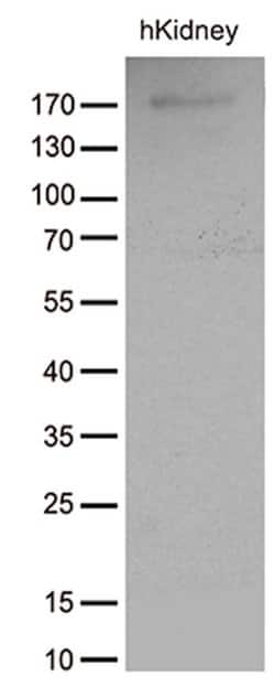 ACE Monoclonal Antibody (OTI2C8), TrueMAB , OriGene 100 &mu;L; Unconjugated:Antibodies,