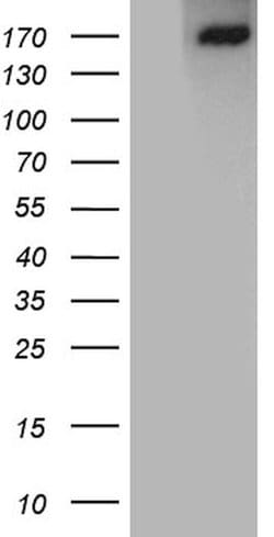 ACE Monoclonal Antibody (OTI2G5), TrueMAB , OriGene:Antibodies:Primary