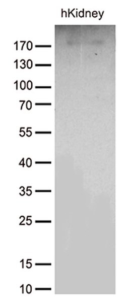 ACE Monoclonal Antibody (OTI2G5), TrueMAB , OriGene:Antibodies:Primary
