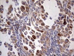 ACE2 Mouse anti-Human, Clone: OTI4D2, lyophilized, TrueMAB 100 &mu;g; Unconjugated:Antibodies,