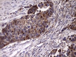 ACE2 Mouse anti-Human, Clone: OTI4D2, lyophilized, TrueMAB 100 &mu;g; Unconjugated:Antibodies,