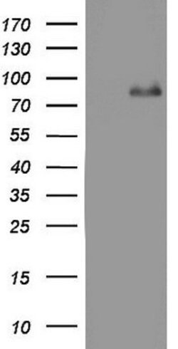 ACE2 Mouse anti-Human, Clone: OTI4D2, lyophilized, TrueMAB 100 &mu;g; Unconjugated:Antibodies,