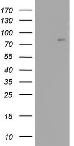 ACE2 Monoclonal Antibody (OTI1D2), TrueMAB , OriGene 100 &mu;L; Unconjugated:Antibodies,