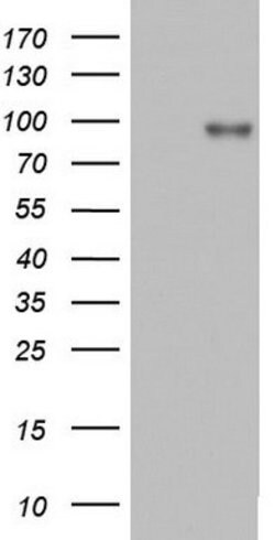 ACE2 Mouse anti-Human, Clone: OTI4C5, lyophilized, TrueMAB 100 &mu;g; Unconjugated:Antibodies,